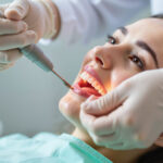 How Long Does it Take to Fill a Cavity?