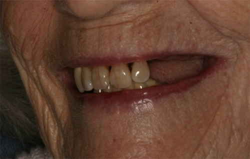 Before dental treatment