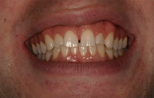 Before dental treatment