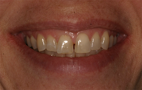 Before dental treatment