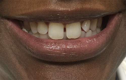 Before dental treatment